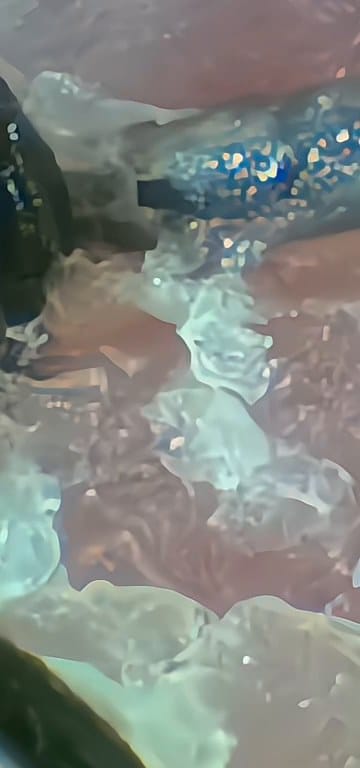 Scalp treatment, microscope scalp check, before